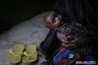 东非旱情持续 大批儿童被饿死
